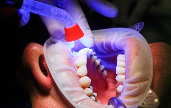 Quels types de soins dentaires peut-on effectuer chez un dentiste ?