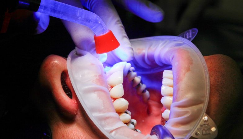 Quels types de soins dentaires peut-on effectuer chez un dentiste ?