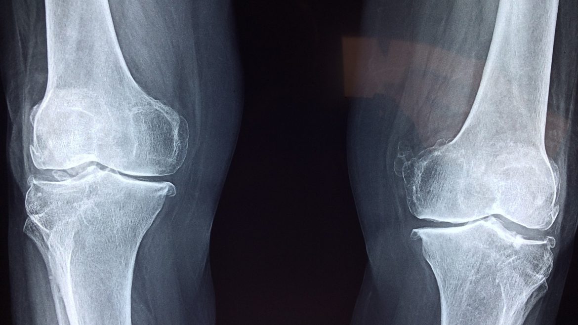 Quels sont les différents types de chirurgie orthopédique ?