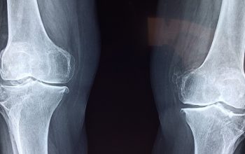 Quels sont les différents types de chirurgie orthopédique ?