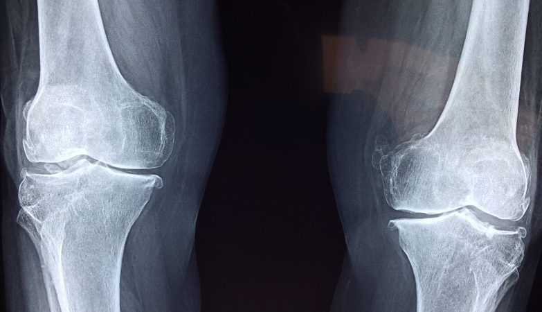 Quels sont les différents types de chirurgie orthopédique ?